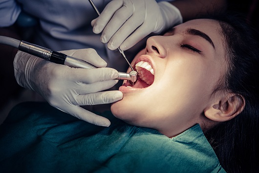 root canal treatment cost in bangalore 